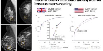 Google desarrolla una inteligencia artificial para detectar el cáncer de mama «capaz de superar a los expertos humanos»