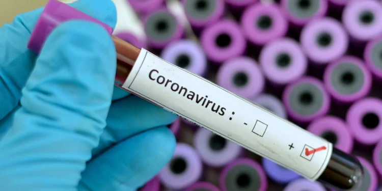 Salud Pública informa de 22 nuevos contagios de COVID-19 en la última semana