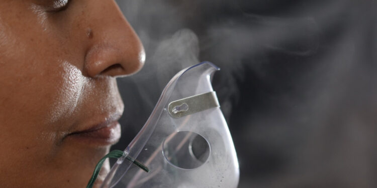 Nicaragua registra 9.341 casos de neumonía en lo que va del 2024, un promedio de 166,8 casos por día