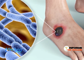 Programa de Tv «La Consulta Medica» sabado,27 de Julio, 2024. @Vtvcacal 32,