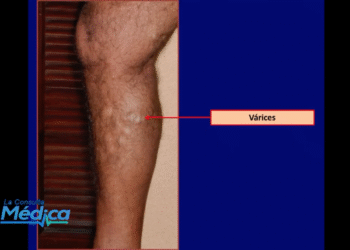 🔴En Directo I 🎙️ Programa de Tv «La Consulta Medica» por @Vtvcacal 32, sabado 10 de Mayo, 2025
